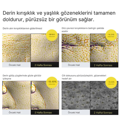 Retinal Shot Tightener Booster Krem